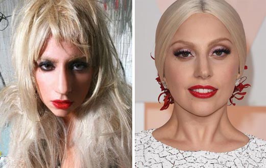 Pop sensation lady gaga says she is an avid fan of facelift tape and uses i...